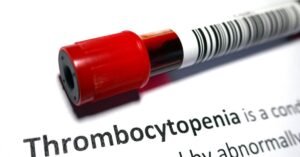 Managing Low Platelet Count with Elborom 50mg Tablet: A Key Treatment for ITP and Hepatitis C